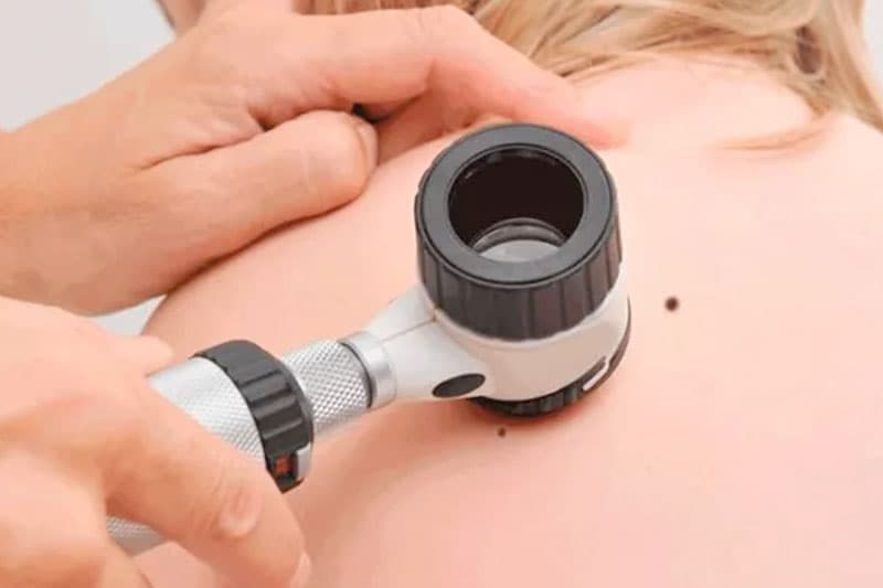 Dermatoscopia e Tricoscopia
