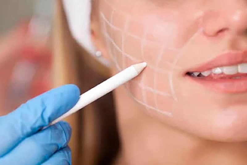 Skinbooster